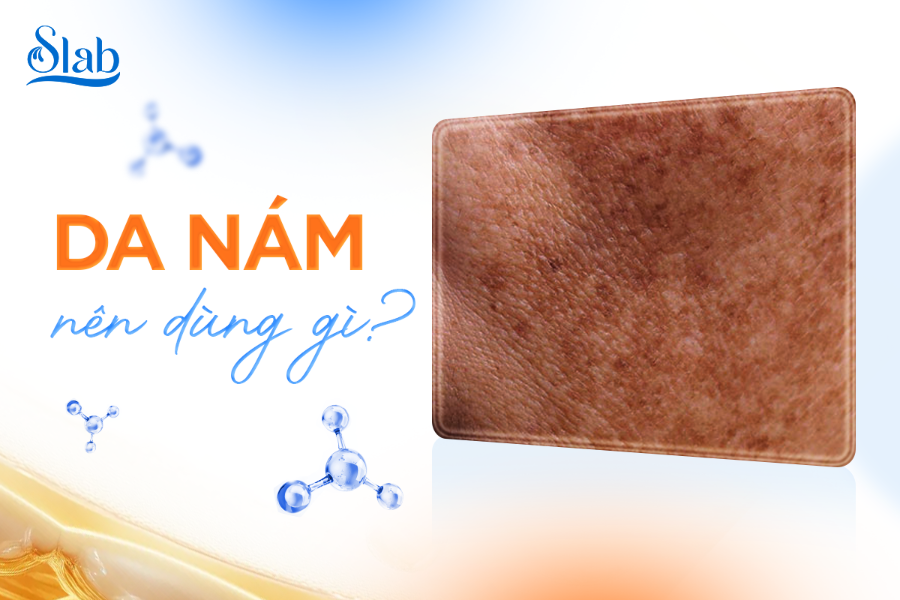 Da nám nên dùng gì? Giải pháp chăm da chuyên sâu cho làn da bị nám